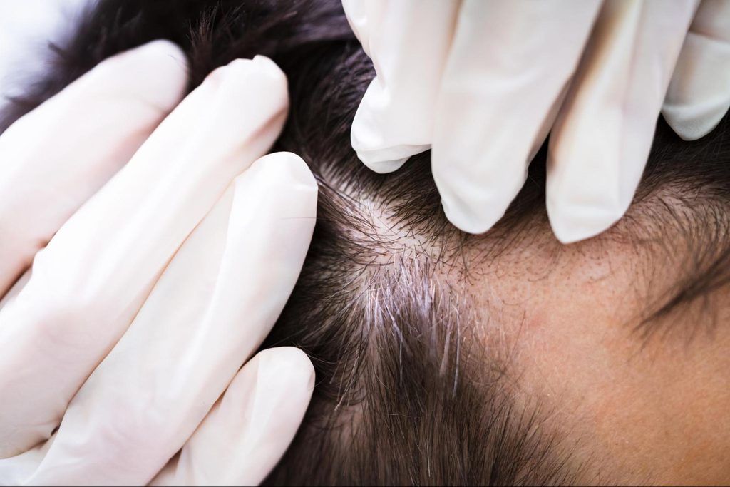 Hair Transplant Clinic Bangkok